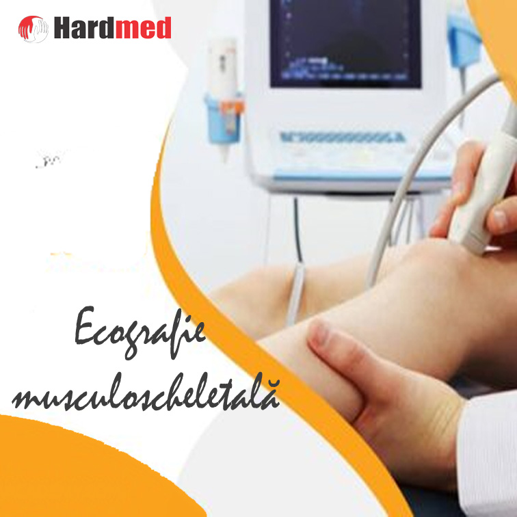 CONSULTAȚII REUMATOLOGIE
CENTRU MEDICAL HARDMED
☎️Tel: 0784 948 888
www.hardmed.ro

🏢𝗘𝗰𝗼𝗴𝗿𝗮𝗳𝗶𝗮 𝗺𝘂𝘀𝗰𝘂𝗹𝗼𝘀𝗰𝗵𝗲𝗹𝗲𝘁𝗮𝗹𝗮̆

 ‍‼️🔝‍👨‍⚕️ Este o metodă diagnostică ☑️ complexă, ☑️ precisă, ☑️ fără efecte secundare pentru pacient, ☑️neiradiantă, ☑️neinvazivă, ☑️ nedureroasă, care ☑️ se poate efectua ori de câte ori este nevoie aducând un real beneficiu în diagnosticul şi urmărirea unei game largi de afecţiuni musculoscheletale.

✅ Ecografia musculoscheletală permite explorarea structurilor musculoscheletale şi a părţilor moi superficiale, aducând informaţii similare rezonanţei magnetice, însă la un preţ mult mai redus, ceea ce o face a fi 𝗺𝗲𝘁𝗼𝗱𝗮 𝗱𝗲 𝗽𝗿𝗶𝗺𝗮 𝗶𝗻𝘁𝗲𝗻𝘁̧𝗶𝗲.

‼️ 𝗕𝗲𝗻𝗲𝗳𝗶𝗰𝗶𝗶𝗹𝗲 𝗲𝗰𝗼𝗴𝗿𝗮𝗳𝗶𝗲𝗶 𝗺𝘂𝘀𝗰𝘂𝗹𝗼𝘀𝗰𝗵𝗲𝗹𝗲𝘁𝗮𝗹𝗲:

🟡 studierea structurilor musculoscheletate în mişcare, în timpul manevrelor de flexie-extensie sau contracţie-relaxare musculară
🟡 compresia structurilor examinate
🟡 explorarea Doppler pentru  evaluarea leziunilor inflamatorii sau tumorale

🟡 De asemenea, sub ghidaj ecografic se pot efectua manevre diagnostice sau terapeutice cum ar fi: puncţia biopsie, biopsia formaţiunilor tumorale solide, aspirarea unor colecţii musculare, subcutanate sau articulare, plasarea unui cateter de drenaj percutan, ghidaj pentru injectarea unor tratamente intraarticulare sau musculare.

❤️ Vă așteptăm cu drag, pentru consultații de specialitate, la 𝗖𝗔𝗕𝗜𝗡𝗘𝗧𝗨𝗟 𝗗𝗘  𝗥𝗘𝗨𝗠𝗔𝗧𝗢𝗟𝗢𝗚𝗜𝗘!

➡️ 👍LIKE ! ➡️👉 SHARE!
-------
CENTRU MEDICAL HARDMED, Clinica familiei tale! 👨‍👩‍👦
-------------------------------------------------------
Bistrița-Năsăud, Bistrița, Str.Drumul Dumitrei Vechi nr.1 A ( în spatele Școlii Generale nr. 4, peste calea ferată)
--------------------------------------------------------
#CentruMedicalHardmed #spital #fizioterapie #kinetoterapie #masaj #cardiologie #consultatie #reumatologie #chirurgieplastica #infiltratii #chirurgievasculara #ecografie #ecografiemusculoscheletala #ecografiearticulara #ecografiemusculara #laborator #recuperare #medicinainterna #neurochirurgie #neurologie #doctor #ORL #ortopedie #pneumologie #policlinica #psihiatrie #Bistrita